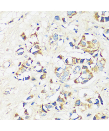 CADPS Rabbit Polyclonal Antibody