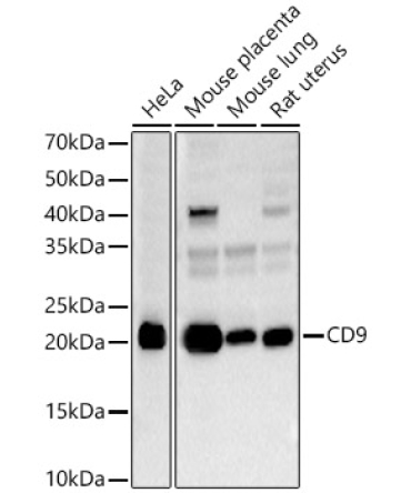 CD9 Rabbit Polyclonal Antibody
