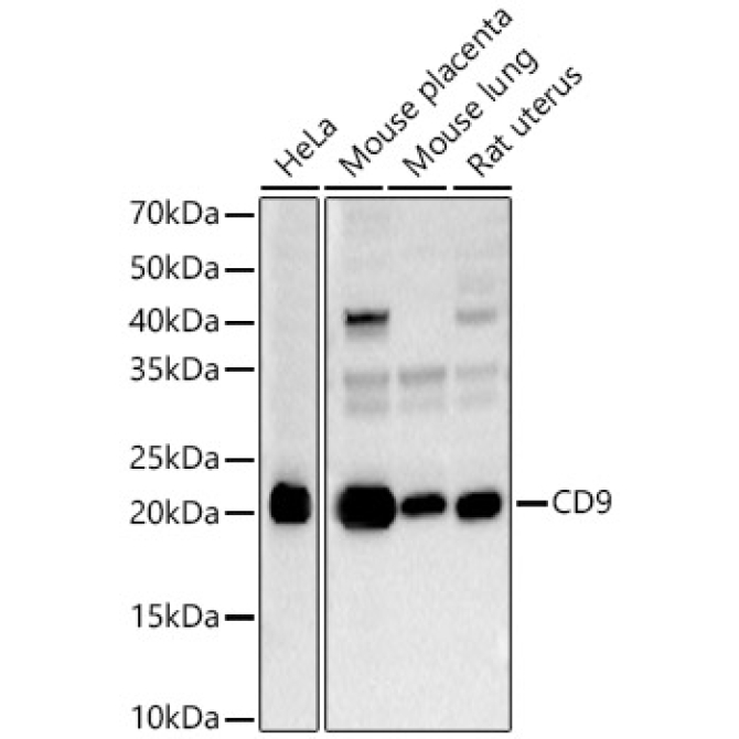 CD9 Rabbit Polyclonal Antibody
