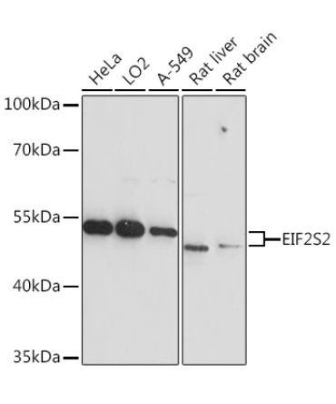 EIF2S2 Rabbit Polyclonal Antibody