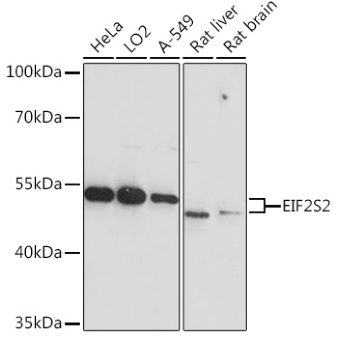 EIF2S2 Rabbit Polyclonal Antibody
