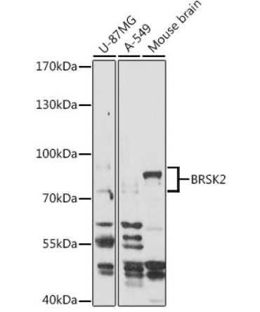 BRSK2 Rabbit Polyclonal Antibody