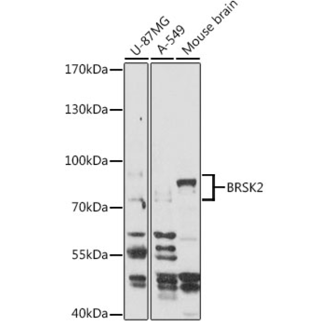 BRSK2 Rabbit Polyclonal Antibody
