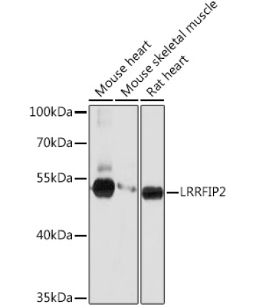 LRRFIP2 Rabbit Polyclonal Antibody