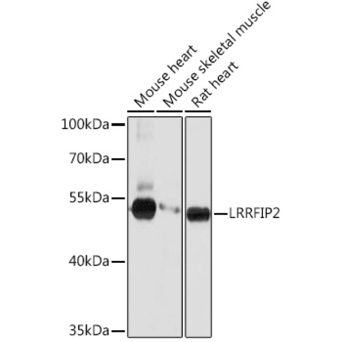 LRRFIP2 Rabbit Polyclonal Antibody