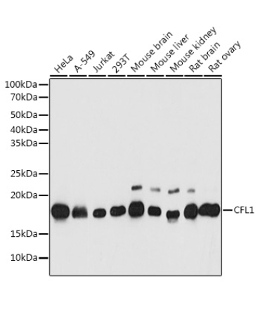 CFL1 Rabbit Polyclonal Antibody