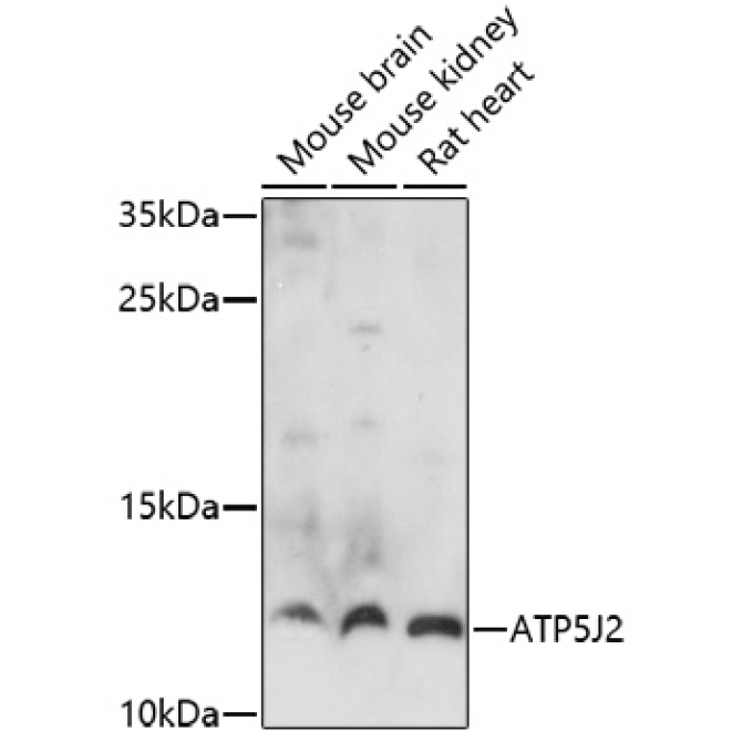 ATP5J2 Rabbit Polyclonal Antibody