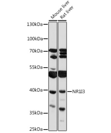 NR1I3 Rabbit Polyclonal Antibody