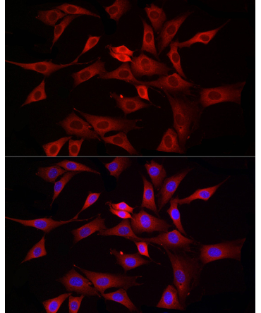 DRP1 Rabbit Polyclonal Antibody