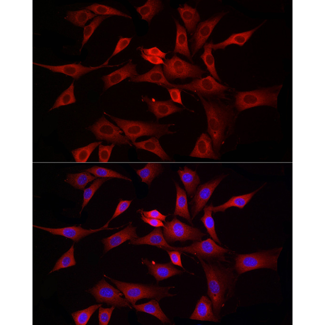 DRP1 Rabbit Polyclonal Antibody