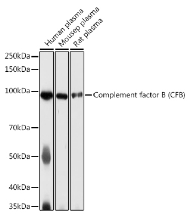 Complement factor B (CFB) Rabbit Polyclonal Antibody