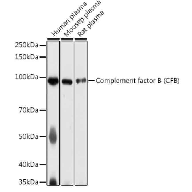Complement factor B (CFB) Rabbit Polyclonal Antibody