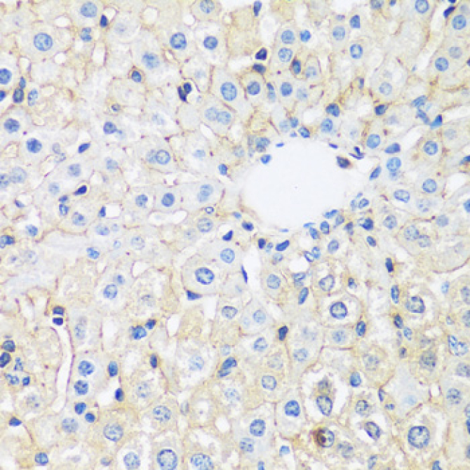 ARL4A Rabbit Polyclonal Antibody