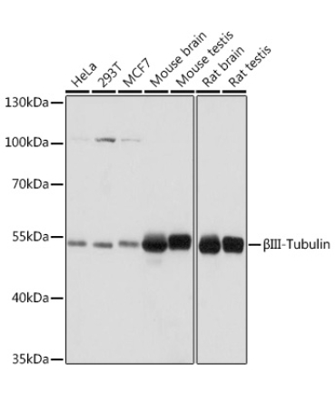 BetaIII-Tubulin Rabbit Polyclonal Antibody [KO Validated]