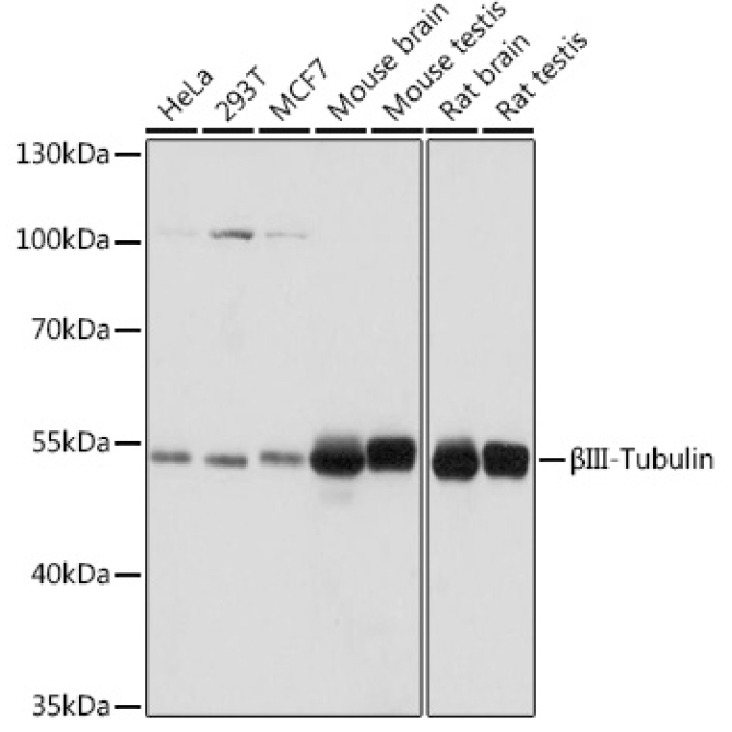 BetaIII-Tubulin Rabbit Polyclonal Antibody [KO Validated]