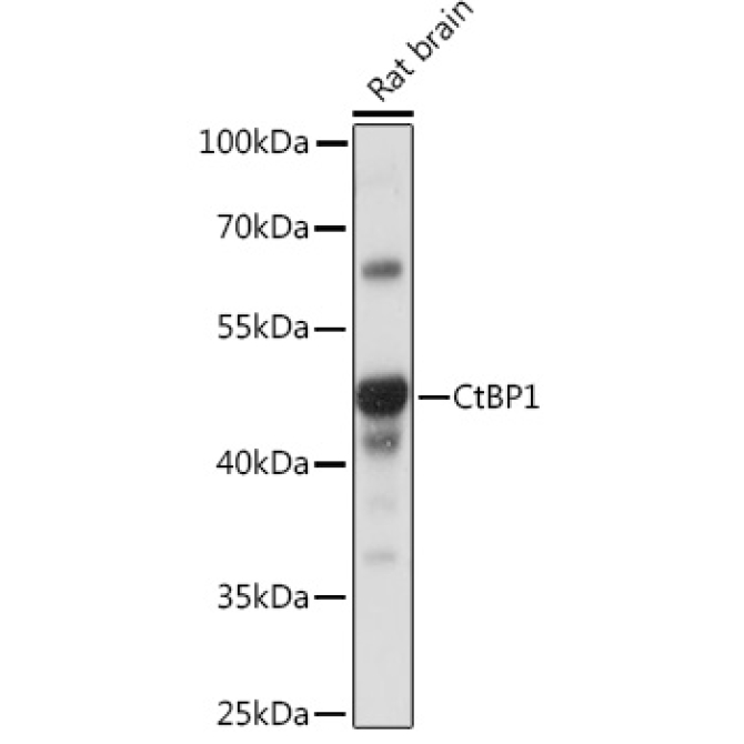 CtBP1 Rabbit Polyclonal Antibody