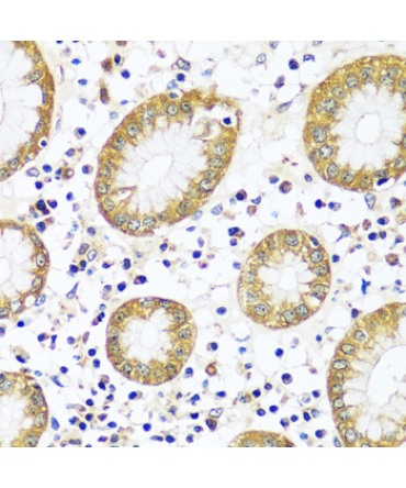CAPN9 Rabbit Polyclonal Antibody