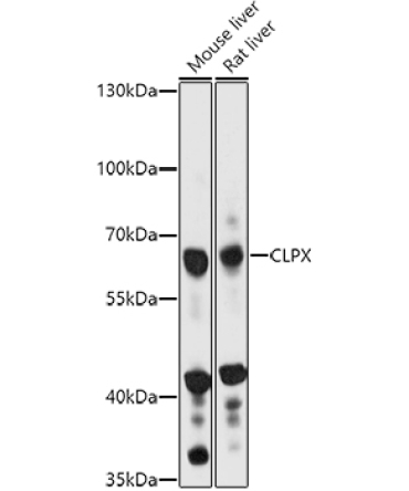 CLPX Rabbit Polyclonal Antibody