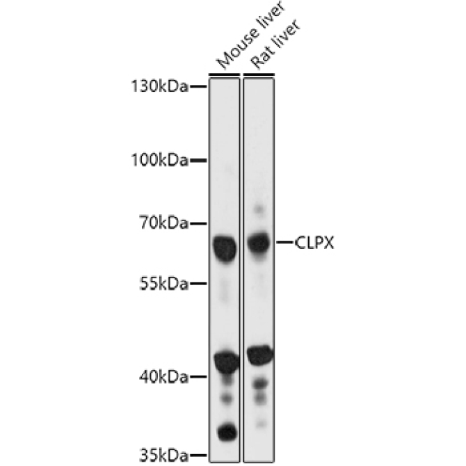 CLPX Rabbit Polyclonal Antibody