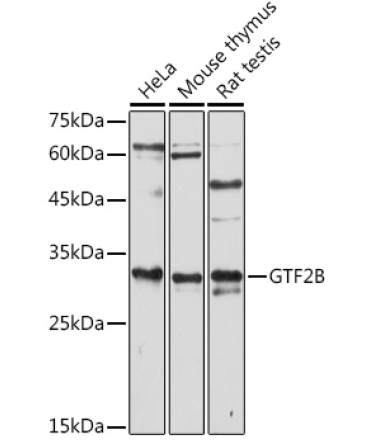 GTF2B Rabbit Polyclonal Antibody