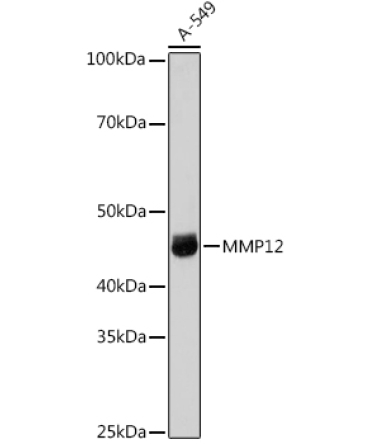 MMP12 Rabbit Polyclonal Antibody