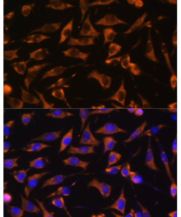 KANK1 Rabbit Polyclonal Antibody