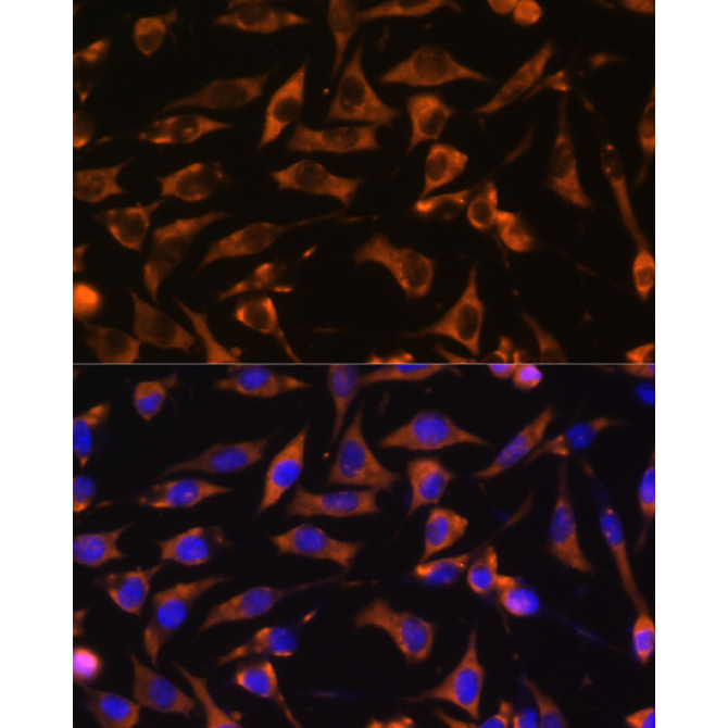 KANK1 Rabbit Polyclonal Antibody