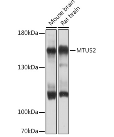 MTUS2 Rabbit Polyclonal Antibody