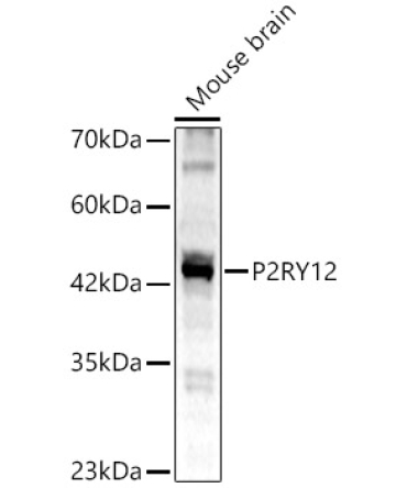P2RY12 Rabbit Polyclonal Antibody