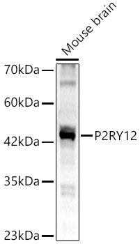 P2RY12 Rabbit Polyclonal Antibody