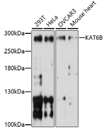 KAT6B Rabbit Polyclonal Antibody