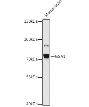 GGA1 Rabbit Polyclonal Antibody