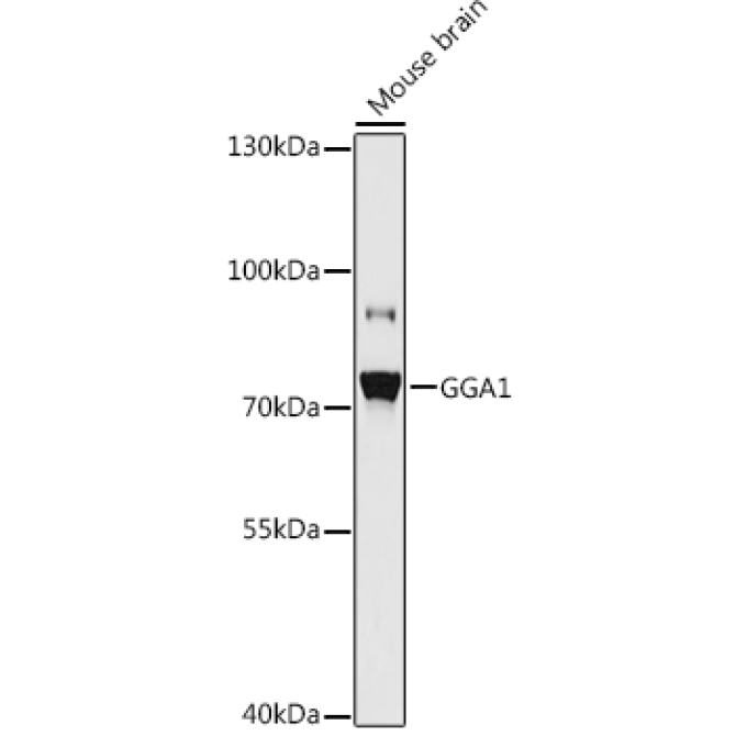 GGA1 Rabbit Polyclonal Antibody