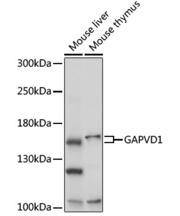 GAPVD1 Rabbit Polyclonal Antibody