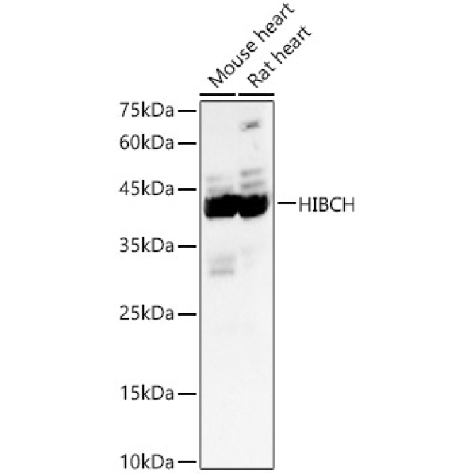 HIBCH Rabbit Polyclonal Antibody