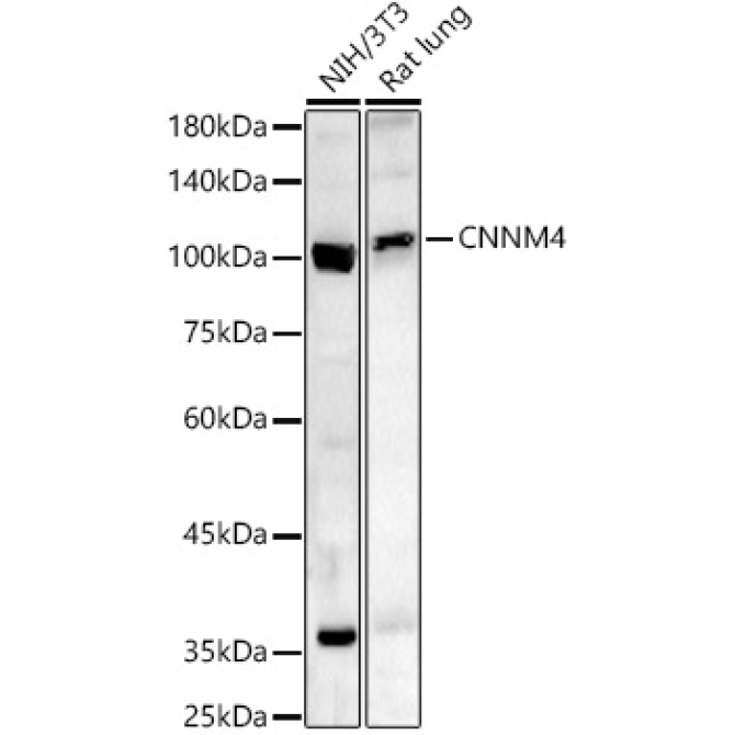 CNNM4 Rabbit Polyclonal Antibody