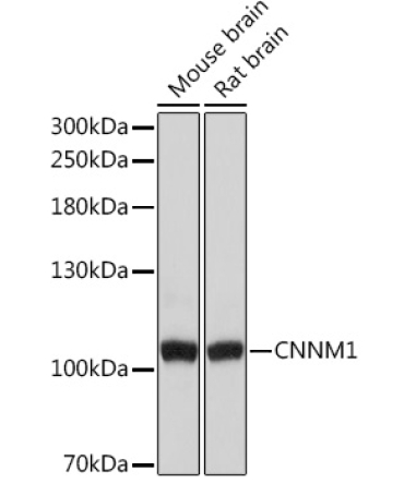 CNNM1 Rabbit Polyclonal Antibody