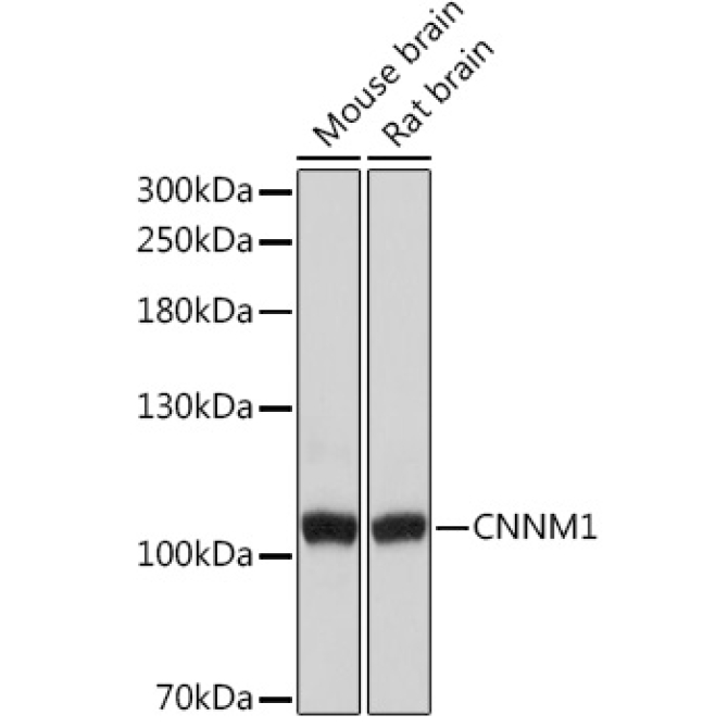 CNNM1 Rabbit Polyclonal Antibody