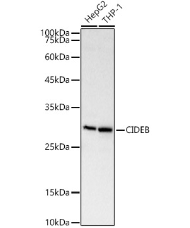 CIDEB Rabbit Polyclonal Antibody