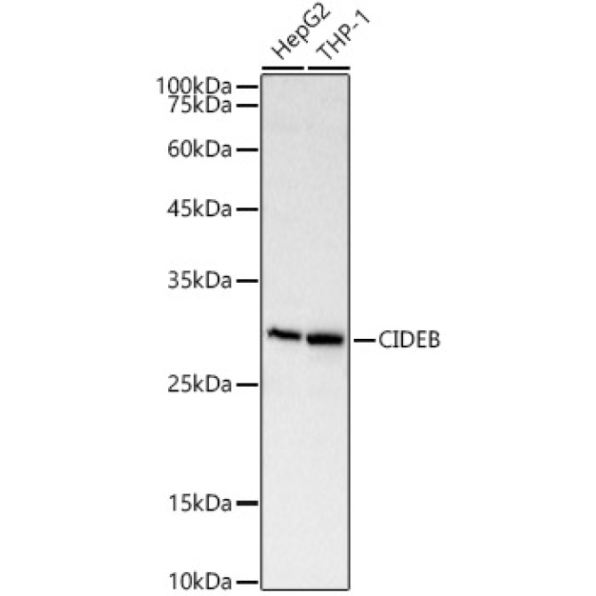 CIDEB Rabbit Polyclonal Antibody