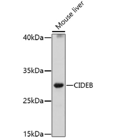 CIDEB Rabbit Polyclonal Antibody