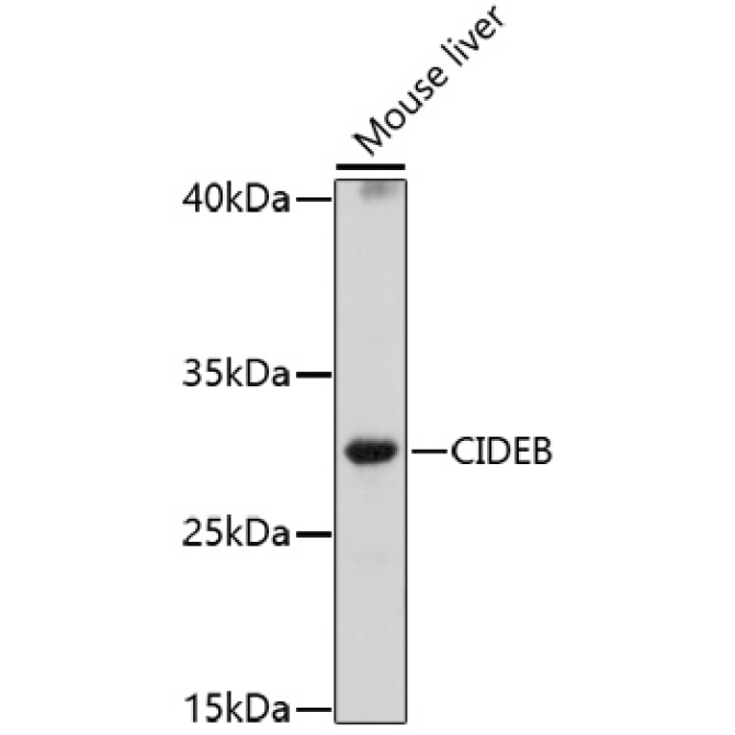CIDEB Rabbit Polyclonal Antibody