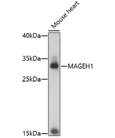 MAGEH1 Rabbit Polyclonal Antibody