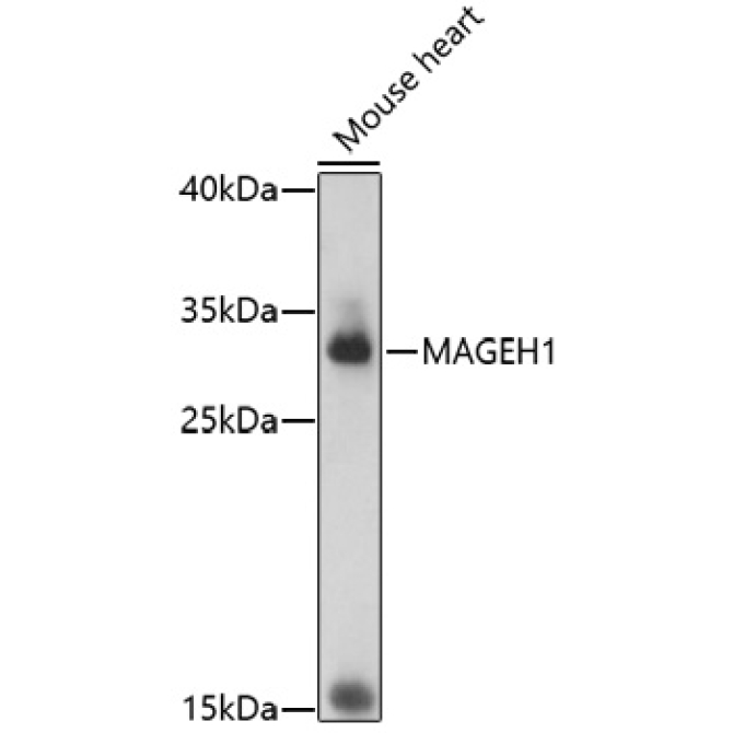 MAGEH1 Rabbit Polyclonal Antibody