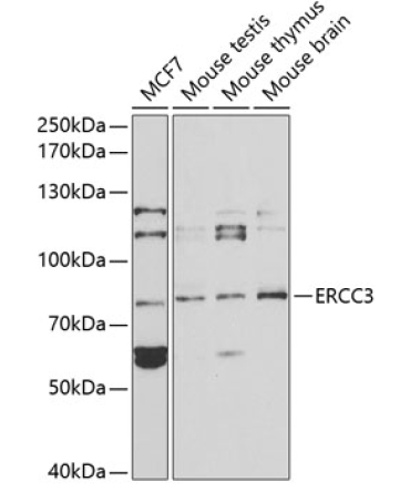 ERCC3 Rabbit Polyclonal Antibody