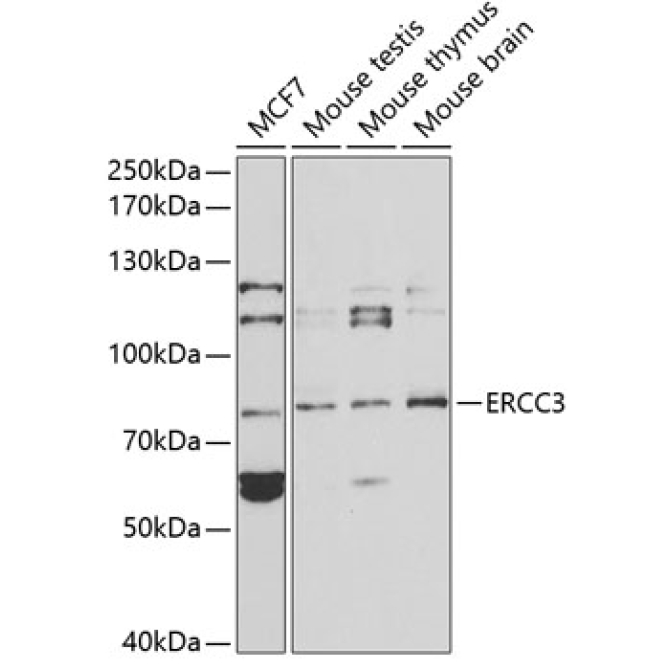 ERCC3 Rabbit Polyclonal Antibody