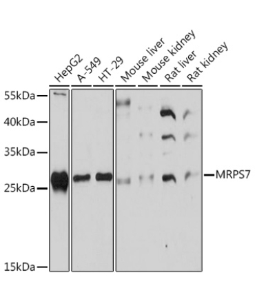 MRPS7 Rabbit Polyclonal Antibody
