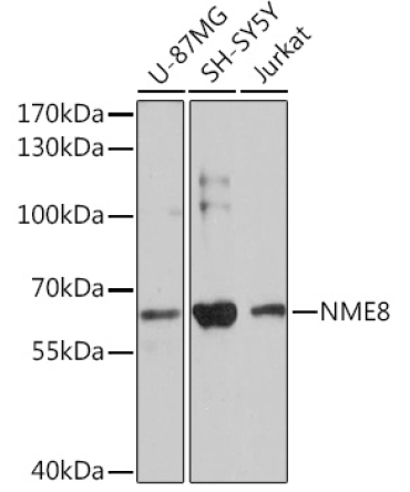 NME8 Rabbit Polyclonal Antibody
