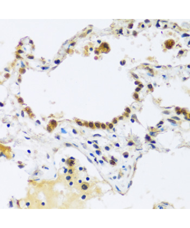 ARL6IP4 Rabbit Polyclonal Antibody