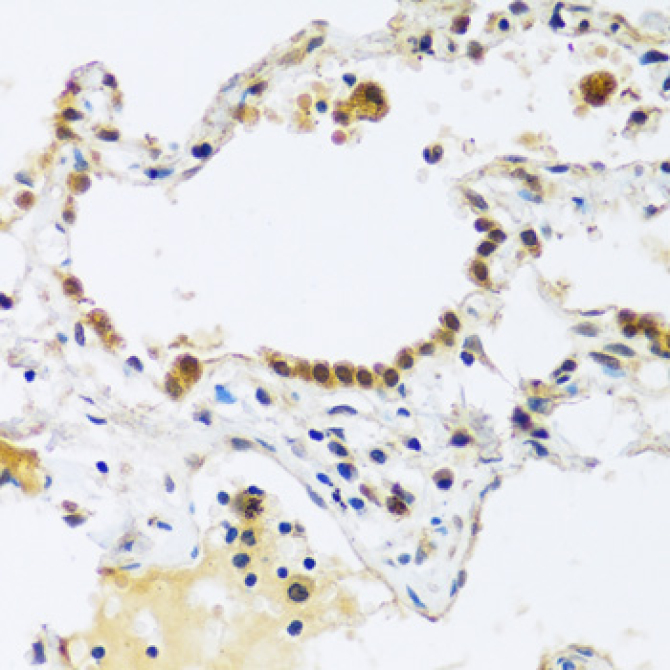 ARL6IP4 Rabbit Polyclonal Antibody